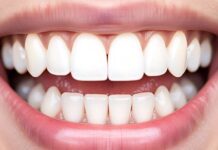 Como Eliminar Dentes Amarelos : Dicas e Tratamentos para um Sorriso Branco