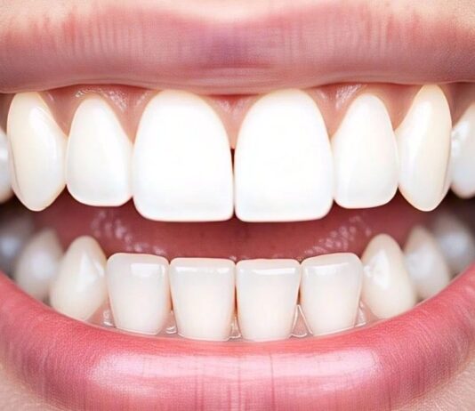 Como Eliminar Dentes Amarelos : Dicas e Tratamentos para um Sorriso Branco